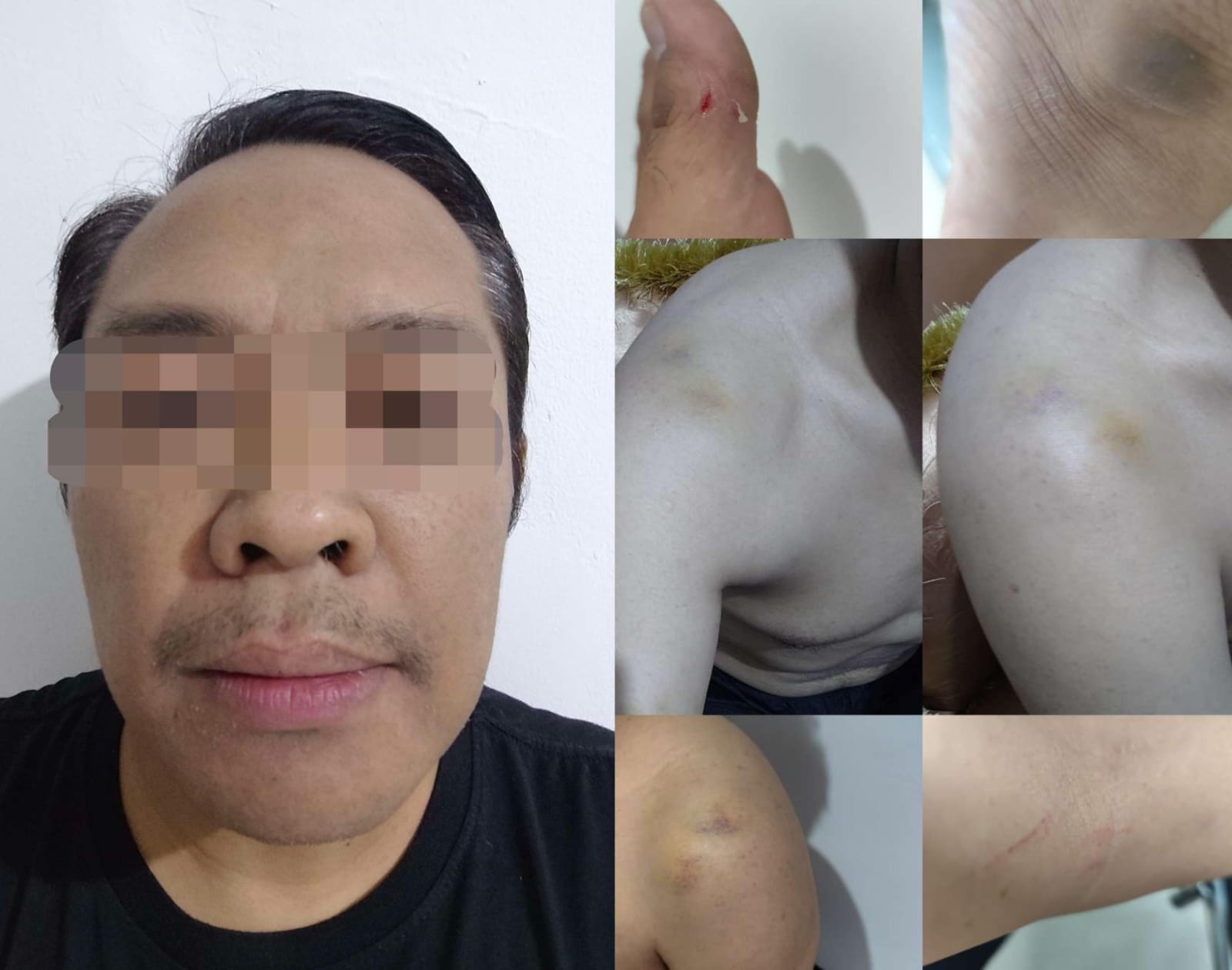 Ketum FRN Agus Flores Soroti Kasus Penganiayaan Terhadap Anggotanya, Polisi Silakan Tangkap Reggy